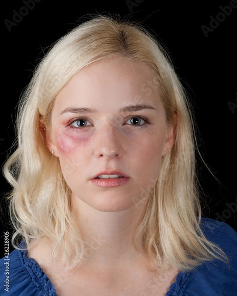 Obraz Ofiara przemocy domowej