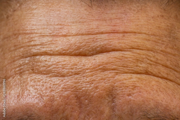 Fototapeta Senior woman's wrinkled forehead, Close up & Macro shot, Selective focus, Light & Shadow, Body part, Healthcare concept