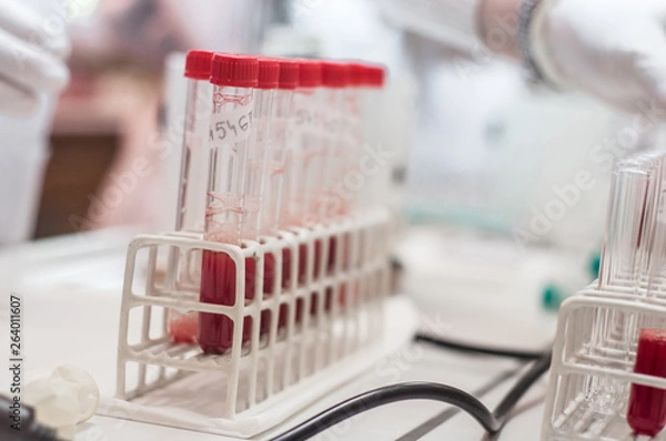 Obraz Close-up test tubes rack