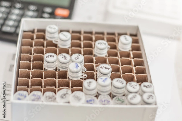 Obraz Close-up test tubes rack