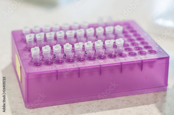 Obraz Close-up test tubes rack