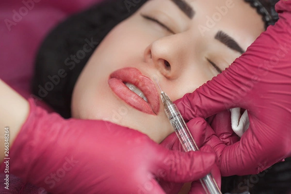 Obraz Cosmetologist making procedure. Dermatologist making an injection of botox or hyaluronic acid. Close up still of lip injection. Lip booster procedure. Beauty salon service.