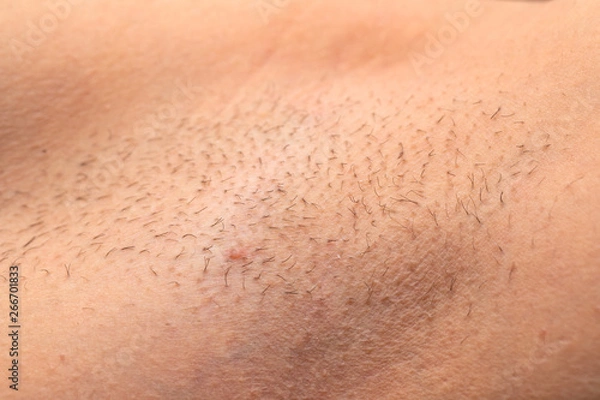 Obraz Unshaved armpit close up