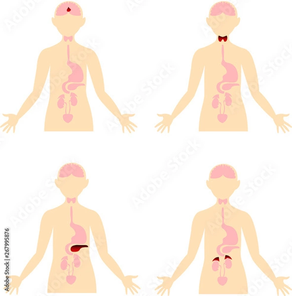 Fototapeta Diseases of the endocrine system. Scheme of the human body. Anatomical image. Endocrinology.