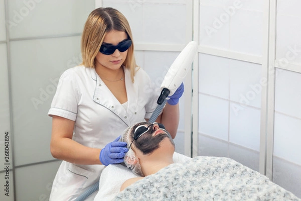 Obraz Peeling węglowy wykonywany przy użyciu wysokiej klasy laser Nd:Yag Q-switch
