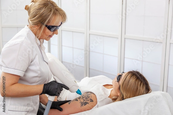Obraz Laserowe usuwanie tatuażu w salonie kosmetycznym - Laser Q-switch
