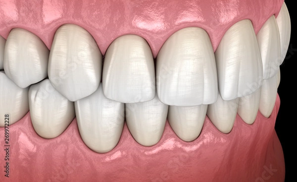 Fototapeta Healthy human teeth with normal occlusion, side view. Medically accurate tooth 3D illustration