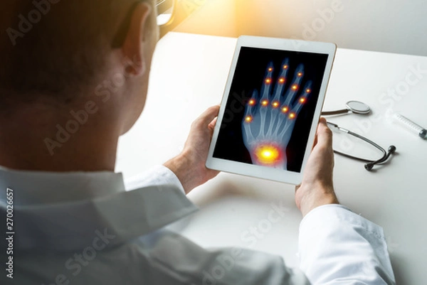 Fototapeta Doctor holding a digital tablet with x-ray of a right hand with pain on the joints of fingers and wrist. Osteoarthritis concept