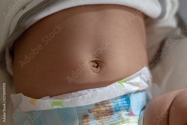 Fototapeta baby belly button