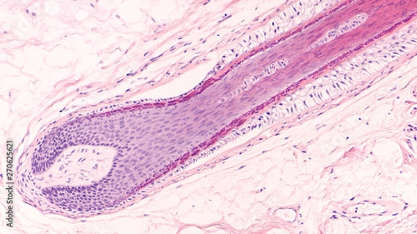 Fototapeta The hair follicle, which resides in the dermal layer of mammalian skin, is made up of 20 different cell types, each with distinct functions.  This micrograph of a skin biopsy shows follicle histology.