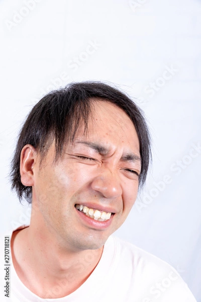 Fototapeta 人物　３０代　男性　薄毛