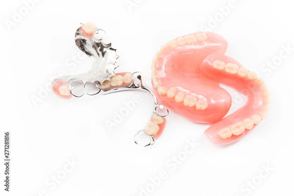 Obraz removable partial denture on white background.