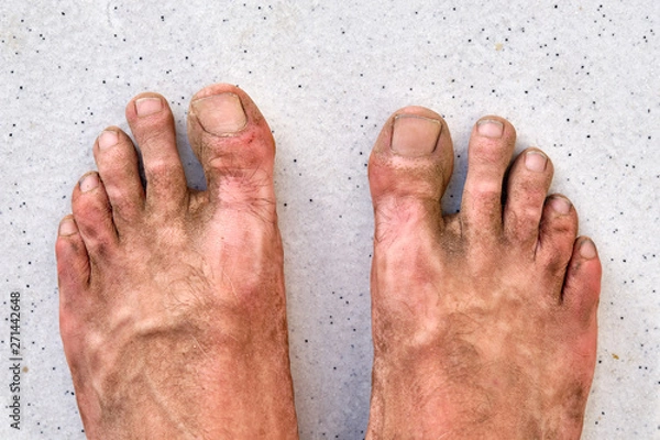 Obraz A pair of dirty sore male feet after a dusty and hot summer hike in outdoor sandals