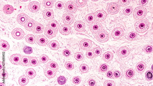 Fototapeta Photomicrograph of the human scalp, showing histology of hair follicles, cut as a tangential cross section.  