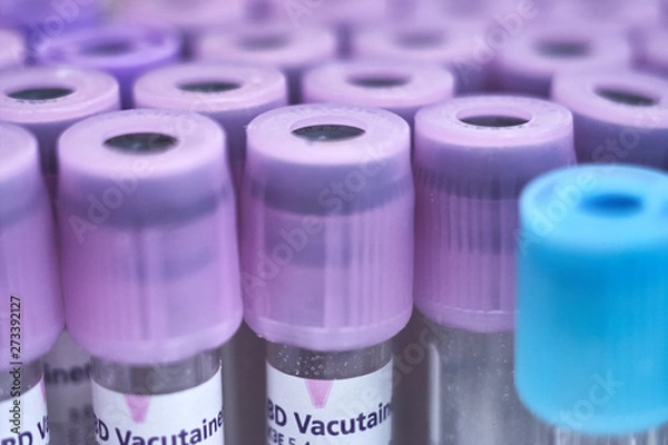Obraz macro of test tubes with purple top, against a gradient of white background. Laboratory