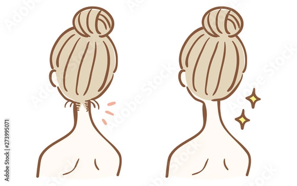 Obraz うなじの脱毛　ビフォーアフター