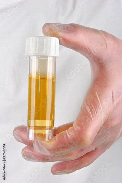 Fototapeta eine Urinprobe in einer Probenflasche