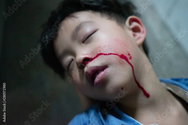 Obraz A boy sick, He has nosebleed while sleeping