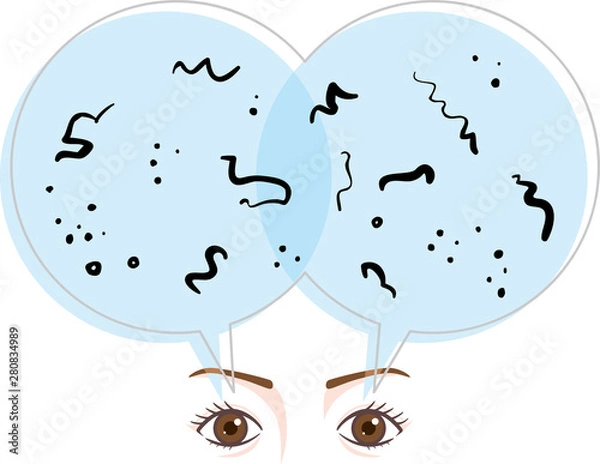 Obraz 目の症状　飛蚊症