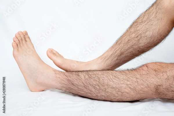 Obraz メンズ　脚脱毛　beforeイメージ