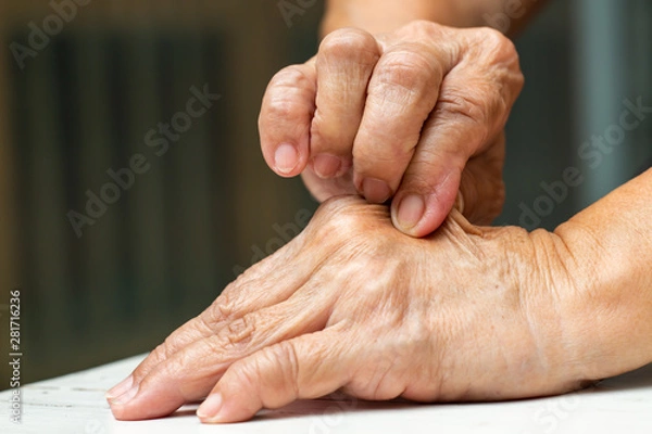 Fototapeta Senior Woman's right hand pinching her left hand, On white table background, Close up shot, Asian Body skin part, Healthcare concept