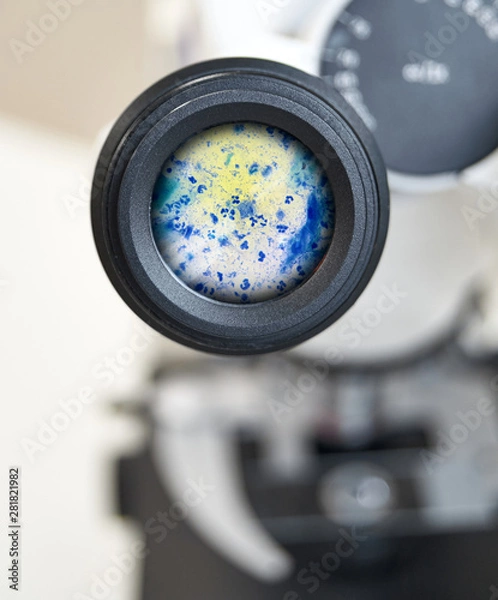 Fototapeta View in the microscope on Trichomonas painted with methylene blue, cytological smear. Selective focus on the eyepiece.