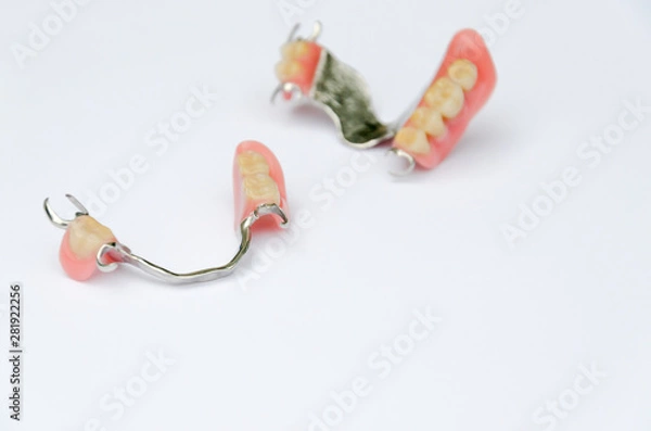 Fototapeta removable clasp prostheses without supporting crowns