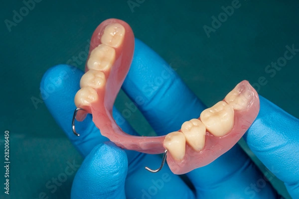 Fototapeta Close-up human denture of the upper jaw on a blue background in the hand of a dentist wearing a medical glove