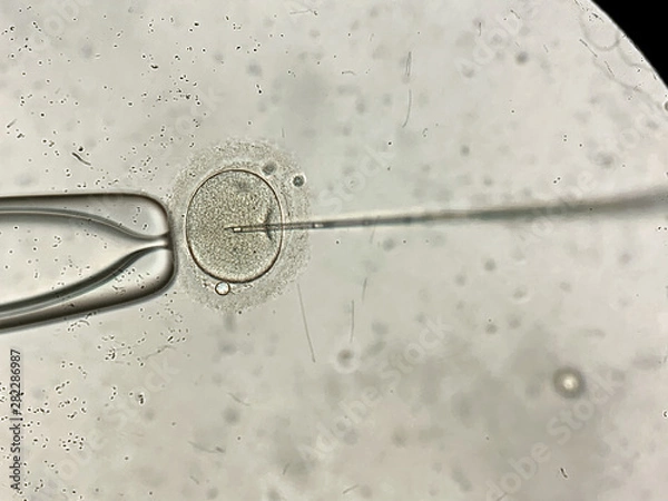 Obraz Zobacz mikroskop w procesie zapłodnienia in vitro