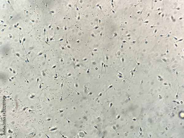 Obraz View at human sperm under microscope in lab