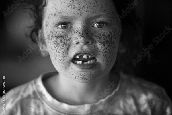 Obraz Freckle Face