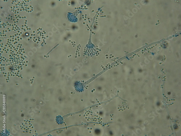 Obraz Aspergillus sp
