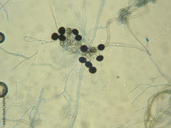 Obraz Nigrospora sp.