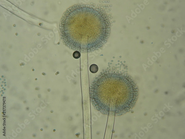 Obraz Aspergillus sp. 