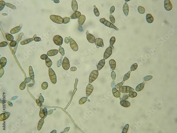 Obraz Alternaria sp.