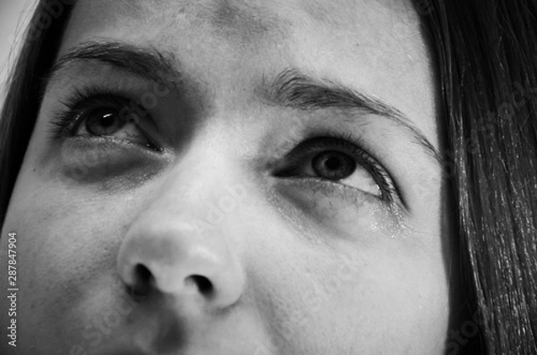 Obraz Sad eyes close-up black and white photo, womans eyes with red capillaries and wrinkles on a white background