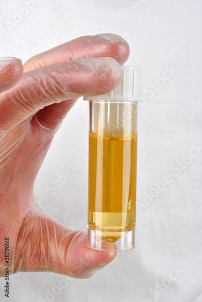 Fototapeta eine Urinprobe in einer Probenflasche