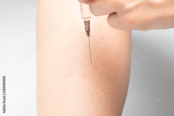 Fototapeta An extreme closeup view on the pointed and sharp end of a hypodermic needle, as a diabetes sufferer injects insulin to stabilize blood sugar levels.
