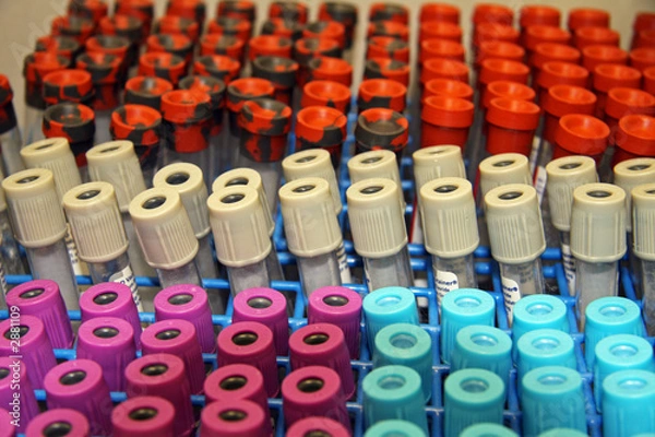 Obraz test tubes