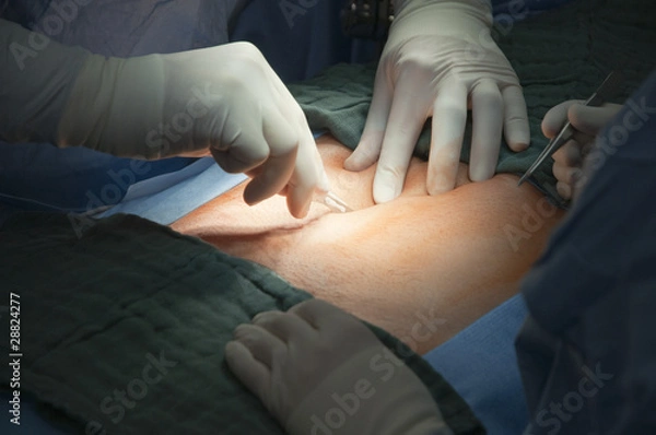 Fototapeta prostata21