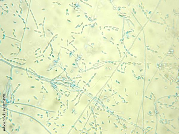 Obraz Paecilomyces sp