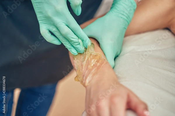 Fototapeta Woman having hair removal procedure on hand with sugaring paste in salon