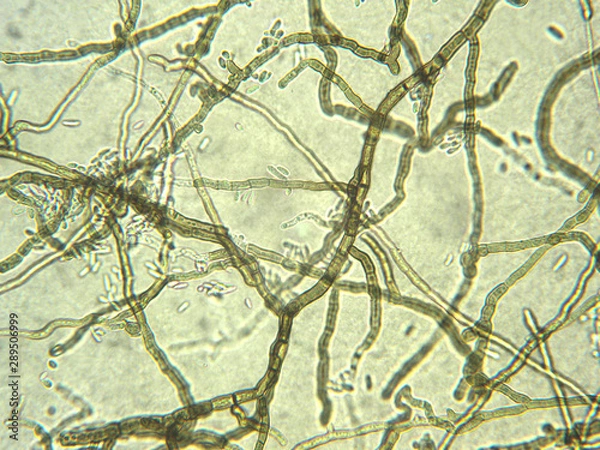 Obraz Aureobasidium