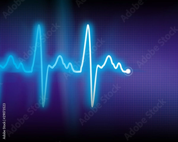 Obraz cardiogram
