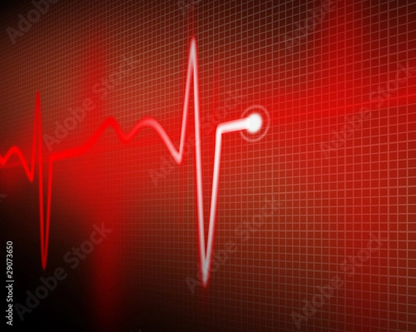 Obraz cardiogram