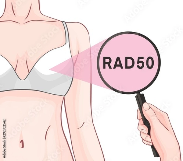 Fototapeta Variants in the RAD50 gene are associated with an increased risk of developing breast cancer