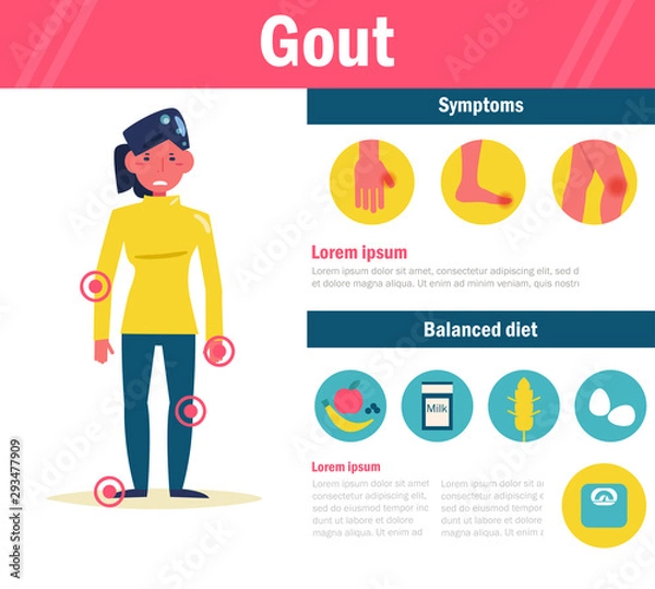 Fototapeta Gout Vector. Cartoon. Isolated art on white background.