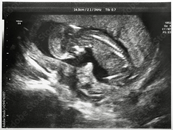 Fototapeta Badanie ultrasonograficzne