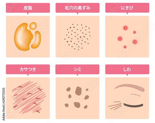 Obraz 肌トラブル 皮脂 毛穴 しみ ニキビ しわ セット