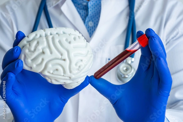 Fototapeta Laboratory medical diagnostics, tests for brain and neurological system concept photo. Doctor or laboratory technician holds in one hand laboratory test tube with blood, in other - figure of brain